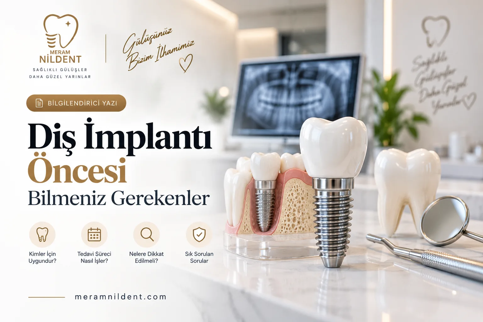 Diş implantı öncesi bilmeniz gerekenler