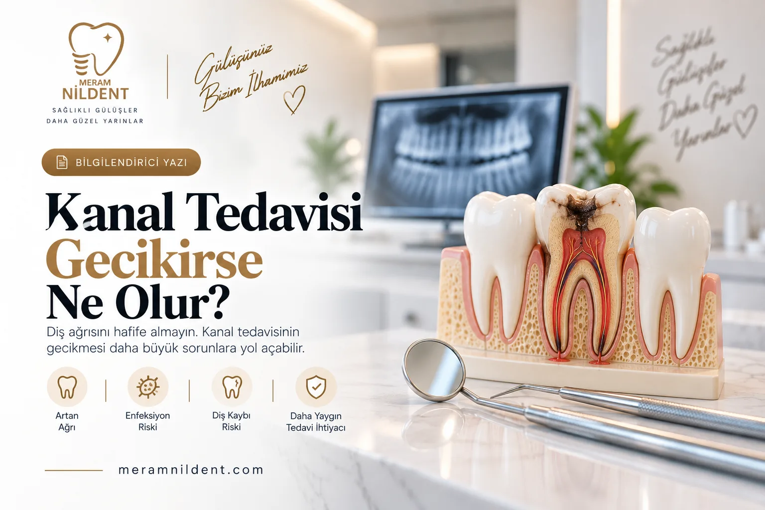 Kanal Tedavisi Gecikirse Ne Olur?